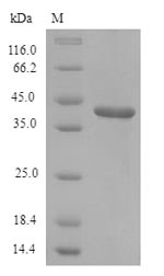 Recombinant Rat Lumican(Lum)