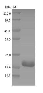Recombinant Mouse Complement receptor type 2(Cr2),partial