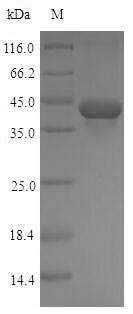 Recombinant Rat Transforming growth factor beta-1(Tgfb1),partial