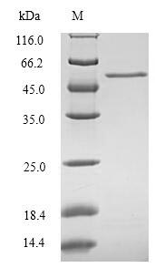 Recombinant Human Protein CYR61(CYR61)