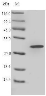 Recombinant Lophura leucomelanos Lysozyme C(LYZ)