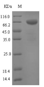 Recombinant Mouse Tryptophan 5-hydroxylase 1(Tph1)