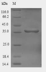 Recombinant Phanerochaete chrysosporium Cellobiose dehydrogenase(CDH-1) ,partial