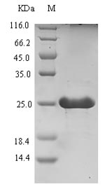 Recombinant Clostridium pasteurianum Rubredoxin(Rd)