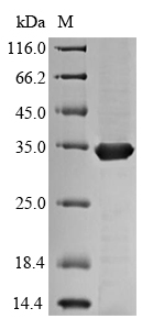 Recombinant Mycobacterium tuberculosis Diacylglycerol acyltransferase/mycolyltransferase Ag85C(fbpC)