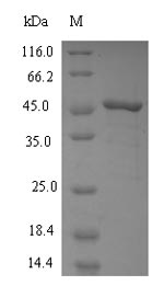Recombinant Human Squalene synthase(FDFT1)