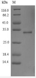 Recombinant Human Thymic stromal lymphopoietin(TSLP)