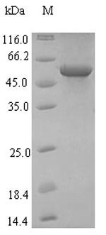 Recombinant Influenza A virus Hemagglutinin(HA)