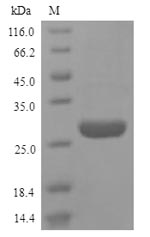 Recombinant Human High mobility group protein B1(Hmgb1)