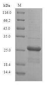 Recombinant Human Guanylate kinase(GUK1)