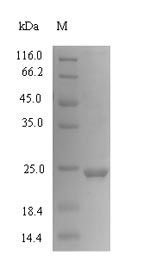 Recombinant Human Growth-regulated alpha protein(CXCL1)