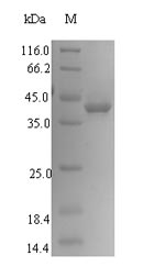 Recombinant Human Signal-regulatory protein gamma(SIRPG),partial
