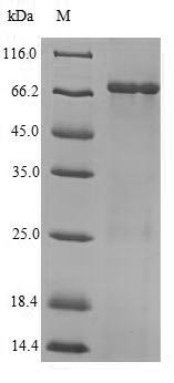 Recombinant Influenza A virus Nucleoprotein(NP)