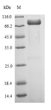 Recombinant Influenza A virus Nucleoprotein(NP)