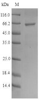 Recombinant Human DNA primase small subunit(PRIM1)
