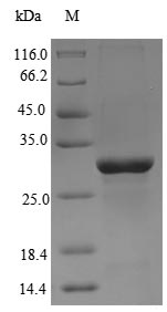 Recombinant Chicken Anosmin-1(ANOS1),partial