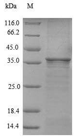 Recombinant Aedes aegypti 37KDA salivary gland allergen Aed a 2(D7)
