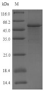 Recombinant Human Poliovirus receptor(PVR),partial