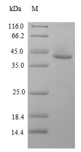 Recombinant Human Zinc finger protein GLI2(GLI2),partial