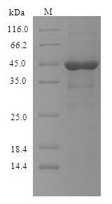 Recombinant Human High affinity immunoglobulin epsilon receptor subunit alpha(FCER1A),partial