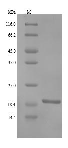 Recombinant Human RING finger protein 11(RNF11)