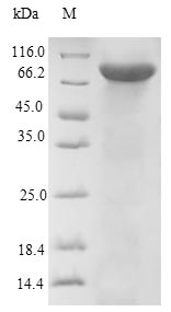 Recombinant Human Dopamine beta-hydroxylase(DBH)