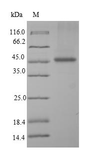 Recombinant Human Paralemmin-1(PALM)