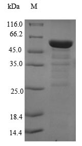 Recombinant Human Eukaryotic translation initiation factor 3 subunit M(EIF3M)