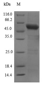 Recombinant Human Cyclic GMP-AMP synthase(MB21D1),partial