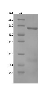 Recombinant Human Aldehyde dehydrogenase family 1 member A3(ALDH1A3)