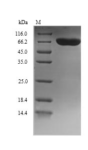 Recombinant Human Dopamine beta-hydroxylase(DBH),partial