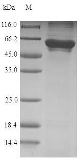 Recombinant Human T-complex protein 1 subunit zeta(CCT6A)