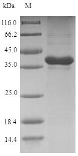 Recombinant Rat Gremlin-1(Grem1)