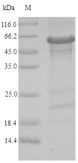 Recombinant Human Zinc finger protein 638(ZNF638),partial
