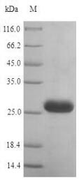 Recombinant Human Histamine H1 receptor(HRH1),partial