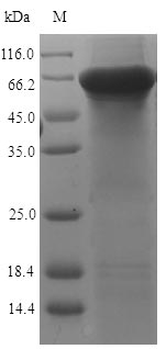 Recombinant Human Keratin, type II cytoskeletal 7(KRT7)