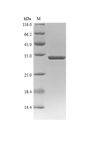 Recombinant Sudan ebolavirus Nucleoprotein(NP),partial