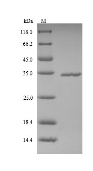 Recombinant Human Ficolin-2(FCN2)