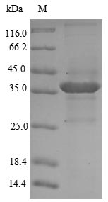 Recombinant Mouse Glutaminyl-peptide cyclotransferase(Qpct)