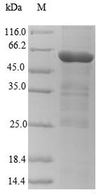 Recombinant Human cytomegalovirus Envelope glycoprotein L(gL)