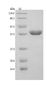 Recombinant Human Galectin-9(LGALS9)