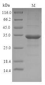Recombinant Cricetulus griseus C-C motif chemokine(I79_001071)