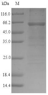 Recombinant Mouse Golgi membrane protein 1(Golm1)