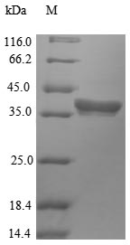 Recombinant Arabidopsis thaliana Histone deacetylase HDT2(HDT2)