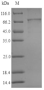 Recombinant Human Aldehyde dehydrogenase family 1 member A3(ALDH1A3)