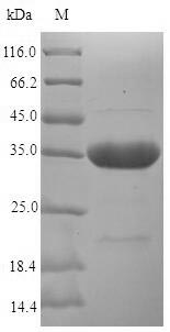 Recombinant Serratia marcescens Hemophore HasA(hasA)