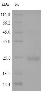 Recombinant Arabidopsis thaliana Histone deacetylase HDT2(HDT2)