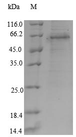 Recombinant Human Runt-related transcription factor 3(RUNX3)