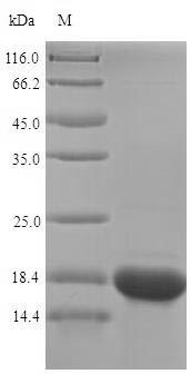 Recombinant Human Selenoprotein M(SELM)