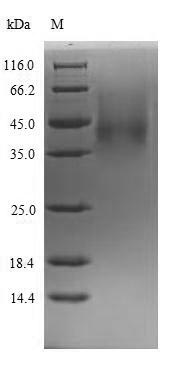 Recombinant Rat Complement factor D(Cfd)